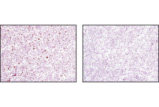 Immunohistochemistry Image 2: Phospho-Stat1 (Tyr701) (58D6) Rabbit Monoclonal Antibody (BSA and Azide Free)