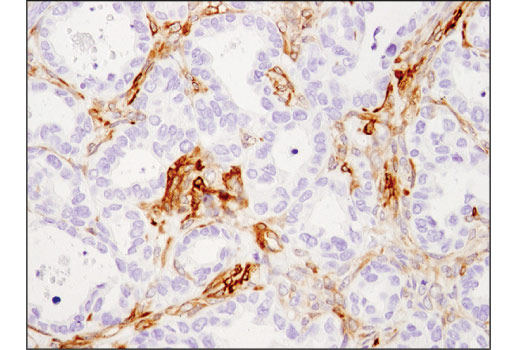 Immunohistochemistry Image 1: Calponin 1 (D8L2T) Rabbit Monoclonal Antibody