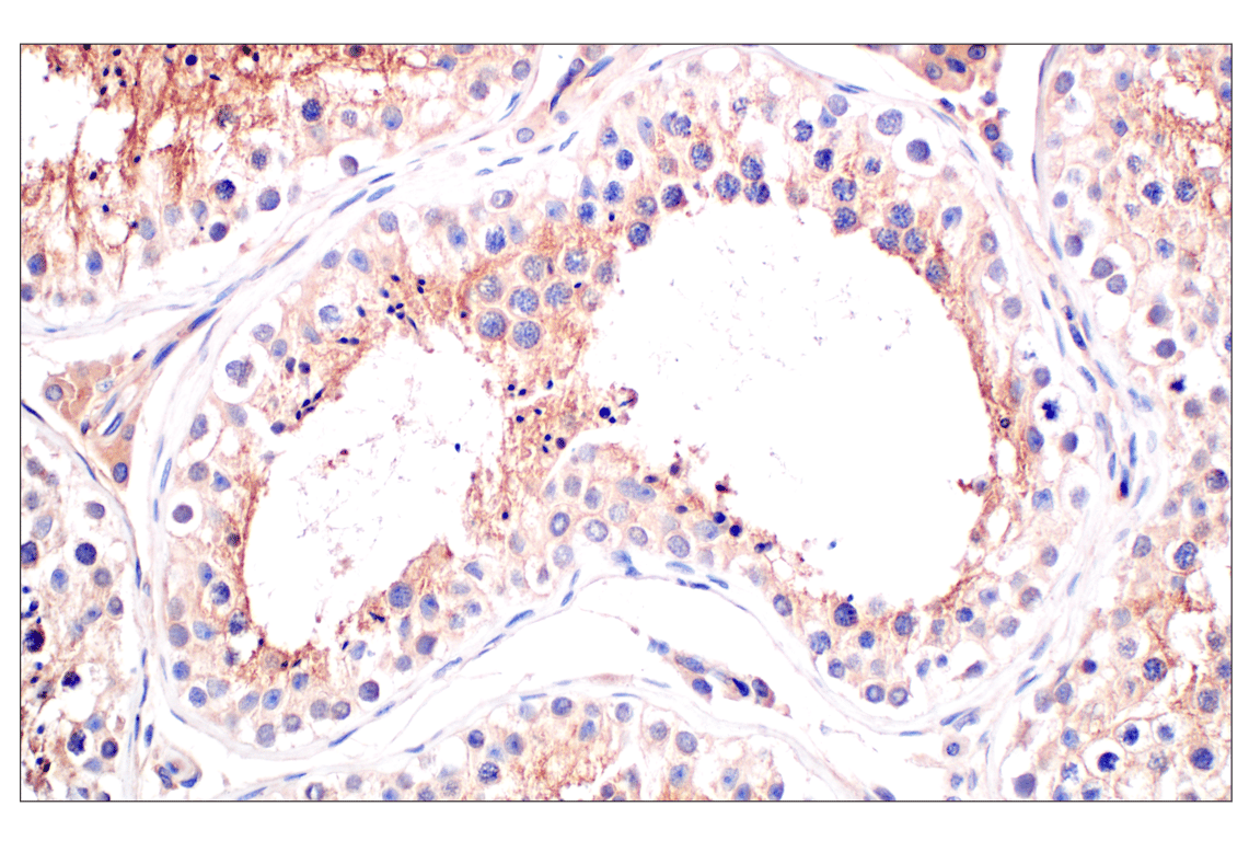 Immunohistochemistry Image 8: CD58 (F1C9B) Rabbit Monoclonal Antibody