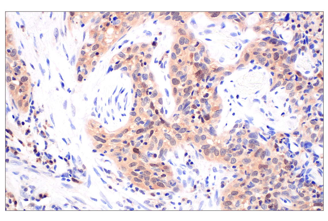 Immunohistochemistry Image 1: CDK6 (E3E3Q) Rabbit Monoclonal Antibody (BSA and Azide Free)