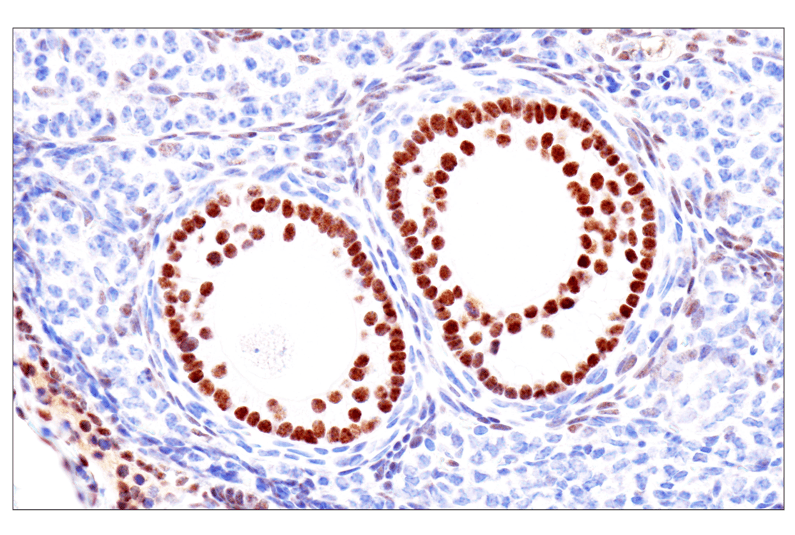 Immunohistochemistry Image 19: GATA-6 (D61E4) Rabbit Monoclonal Antibody (BSA and Azide Free)