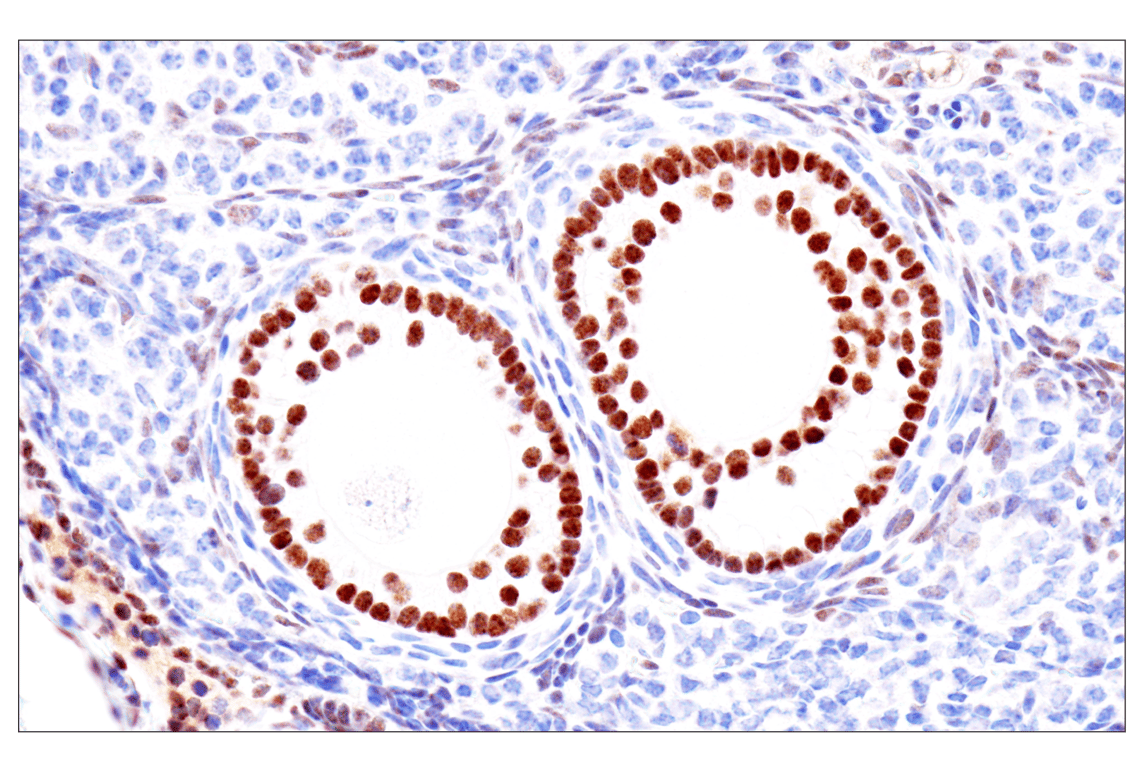 Immunohistochemistry Image 19: GATA-6 (D61E4) XP<sup>®</sup> Rabbit mAb (BSA and Azide Free)