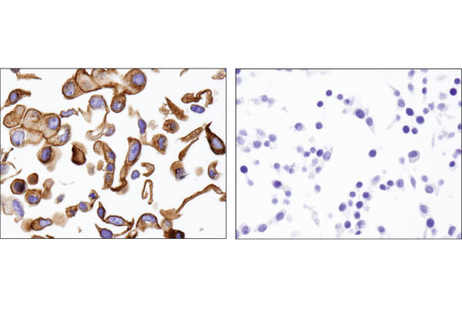 Immunohistochemistry Image 3: NaPi2b/SLC34A2 (D6W2G) Rabbit Monoclonal Antibody