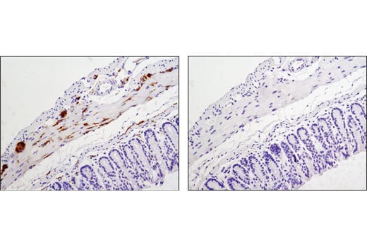 undefined Image 47: Pathological Hallmarks of Alzheimer's Disease Antibody Sampler Kit