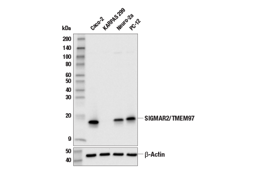 Western Blotting Image 2: SIGMAR2/TMEM97 (E8R4R) Rabbit Monoclonal Antibody