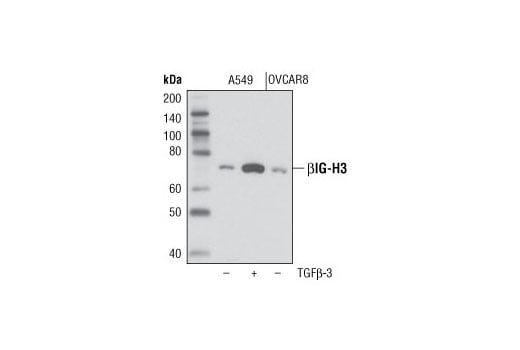 Western Blotting Image 1: βIG-H3 (D31B8) XP<sup>®</sup> Rabbit mAb