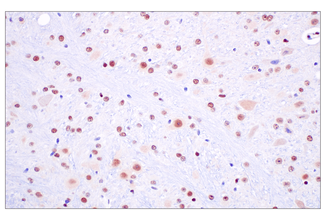 Immunohistochemistry Image 12: FKBP5 (F1G3I) Rabbit Monoclonal Antibody