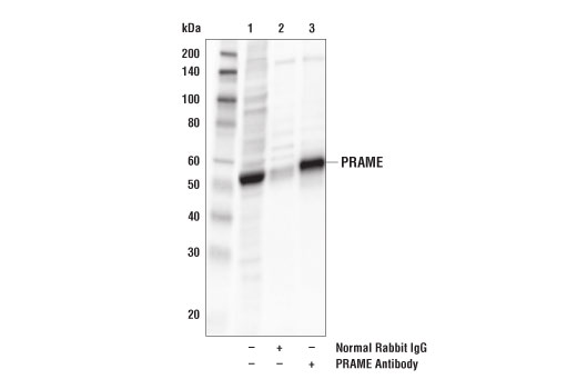 Immunoprecipitation Image 1: PRAME Antibody