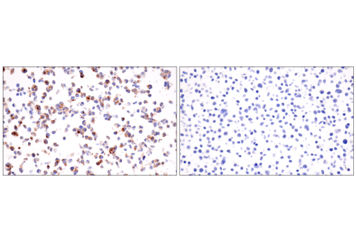Immunohistochemistry Image 7: Neurofilament-H (E7Z7G) Rabbit Monoclonal Antibody