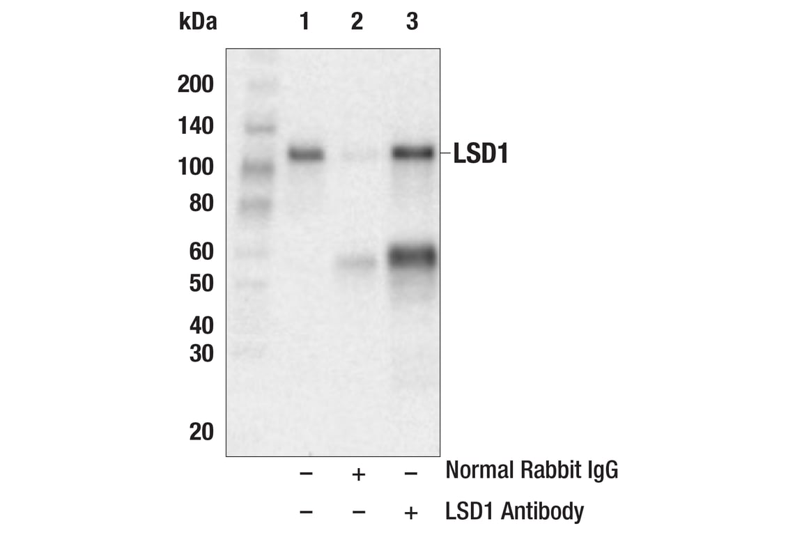 Immunoprecipitation Image 1: LSD1 Antibody