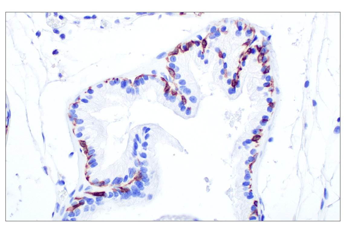 Immunohistochemistry Image 7: Keratin 14 (E7W6V) Rabbit Monoclonal Antibody (BSA and Azide Free)