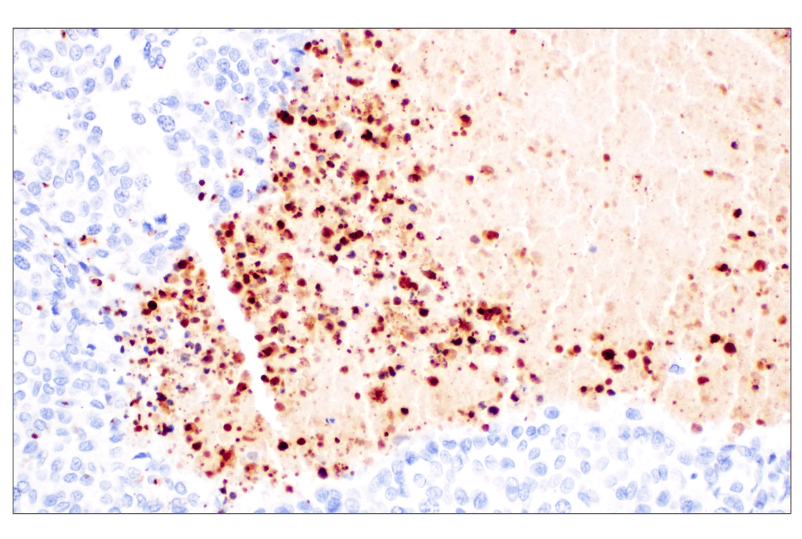 Immunohistochemistry Image 4: Citrullinated Histone H3 (Arg2) (F3C9B) Rabbit Monoclonal Antibody (BSA and Azide Free)