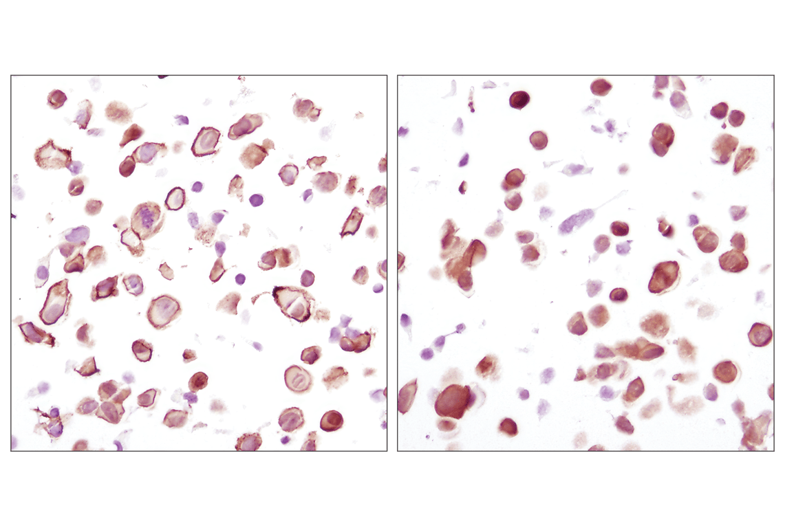 Immunohistochemistry Image 3: Akt (pan) (C67E7) Rabbit Monoclonal Antibody