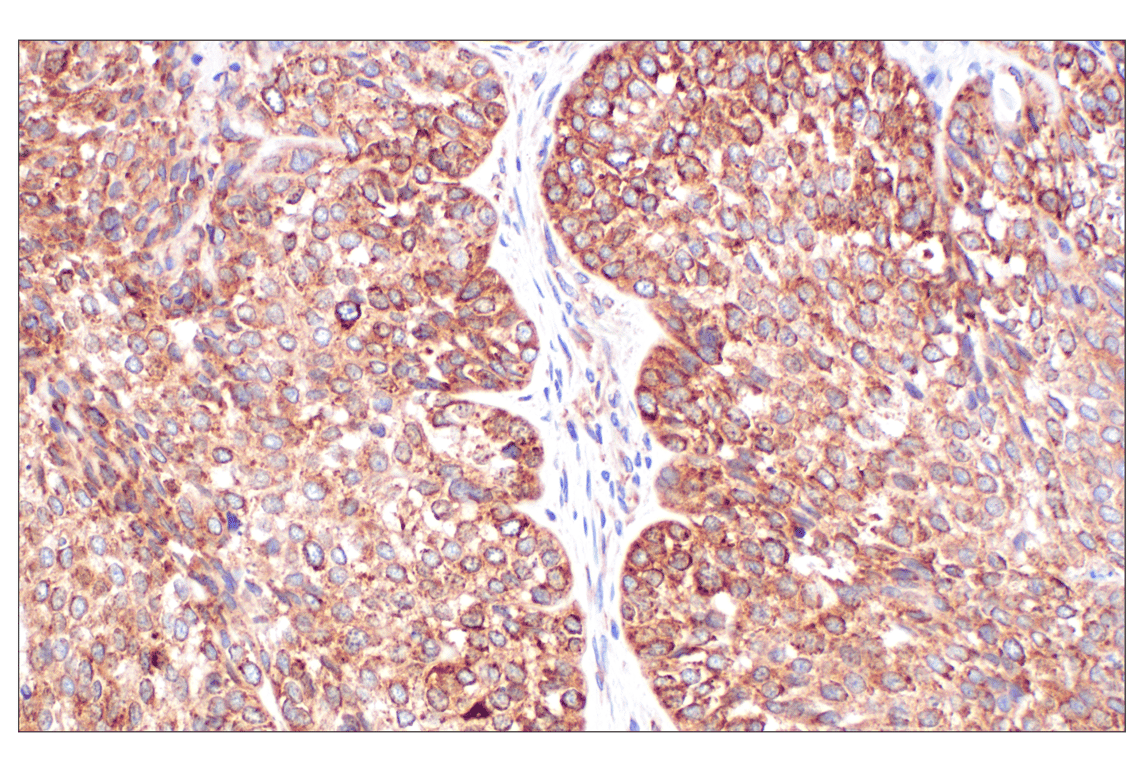 Immunohistochemistry Image 2: PABP1 (F6G6L) Rabbit Monoclonal Antibody
