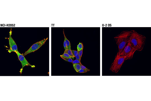 Immunofluorescence Image 1: MTSS1 (D2H4L) Rabbit Monoclonal Antibody