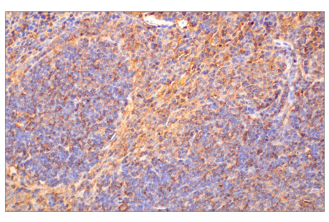 Immunohistochemistry Image 2: CD47 (E2V9V) Rabbit Monoclonal Antibody (BSA and Azide Free)
