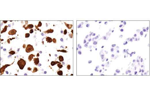 Immunohistochemistry Image 2: Galectin-3/LGALS3 (D4I2R) XP<sup>®</sup> Rabbit mAb