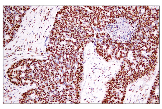 Immunohistochemistry Image 4: ADAR1 (E6X9R) Rabbit Monoclonal Antibody