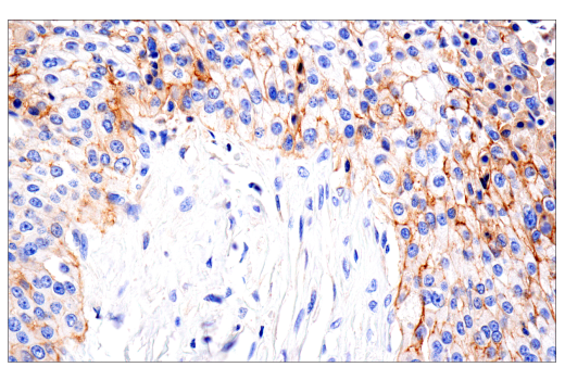 Immunohistochemistry Image 4: NG2/CSPG4 (E3B3G) Rabbit Monoclonal Antibody (BSA and Azide Free)