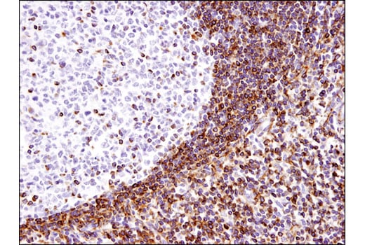 Immunohistochemistry Image 4: Bcl-2 (124) Mouse Monoclonal Antibody