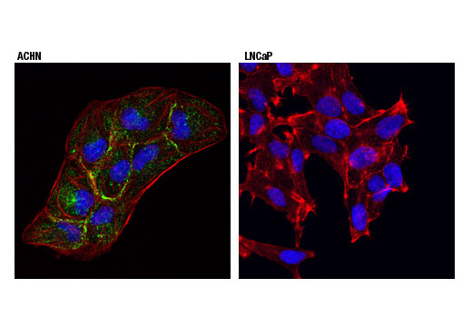 Immunofluorescence Image 1: Cavin-1 (D1P6W) Rabbit Monoclonal Antibody