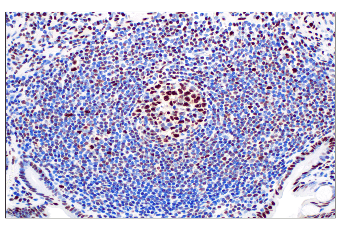 Immunohistochemistry Image 6: NPM1 (E7W4P) Rabbit Monoclonal Antibody (BSA and Azide Free)