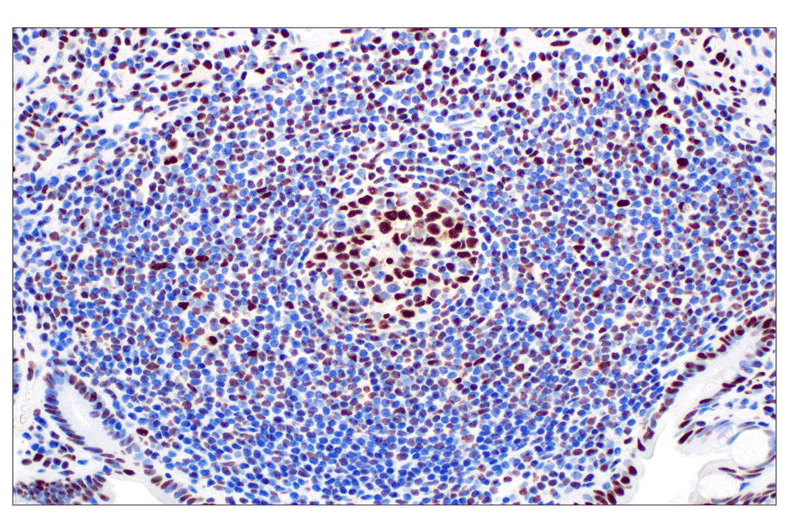 Immunohistochemistry Image 6: NPM1 (E7W4P) Rabbit mAb (BSA and Azide Free)
