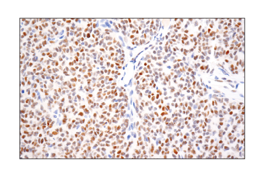 Immunohistochemistry Image 1: PRAME (E7I1B) Rabbit Monoclonal Antibody