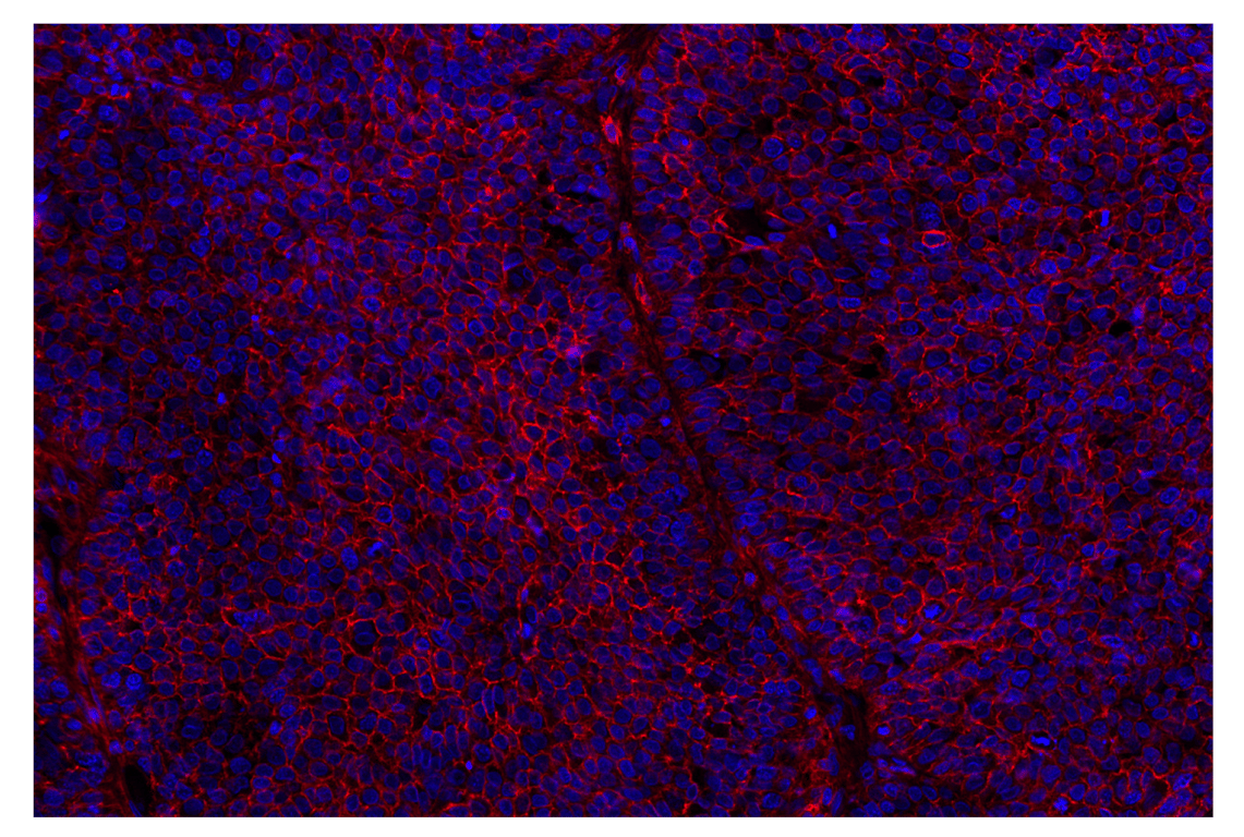 Immunohistochemistry Image 2: CD44 (E7K2Y) Rabbit Monoclonal Antibody (Alexa Fluor<sup>®</sup> 555 Conjugate)