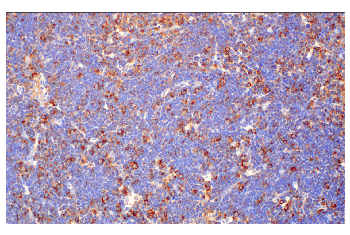 Immunohistochemistry Image 10: RACK1 (D59D5) Rabbit Monoclonal Antibody