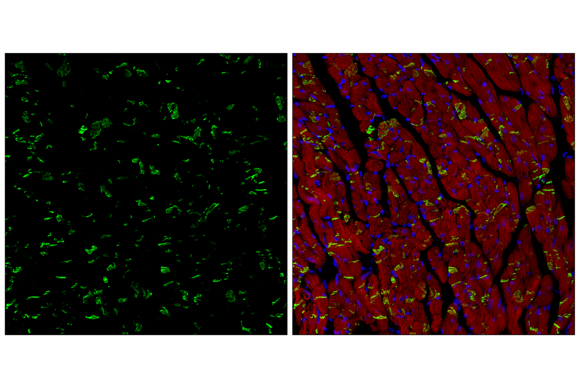 undefined Image 78: Epithelial-Mesenchymal Transition (EMT) Antibody Sampler Kit