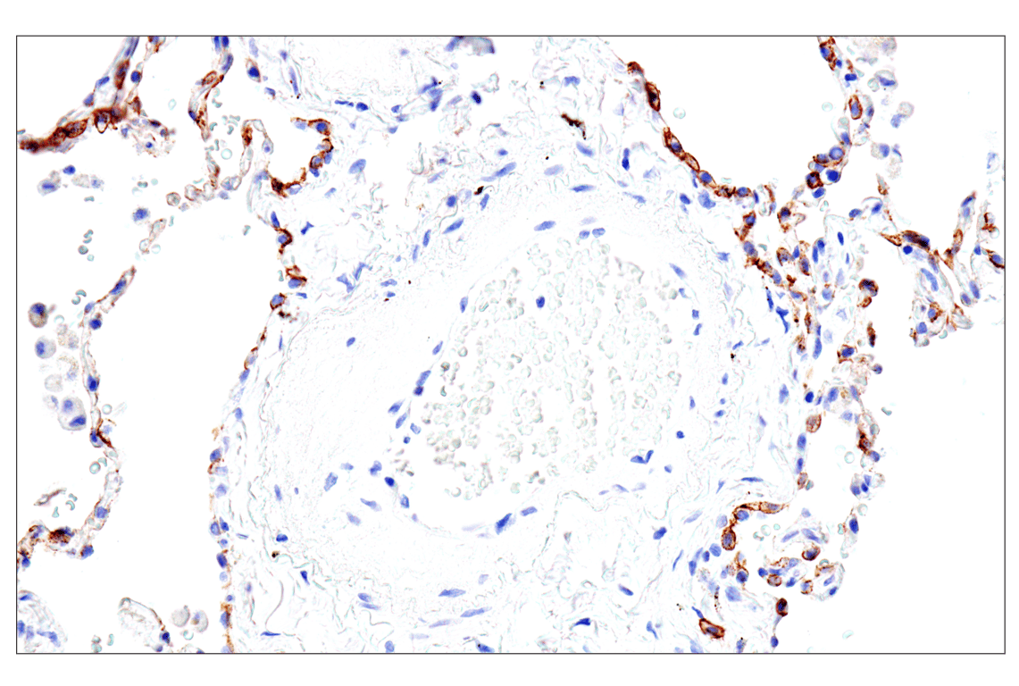 Immunohistochemistry Image 13: Syndecan 1 (E7F7T) Rabbit Monoclonal Antibody