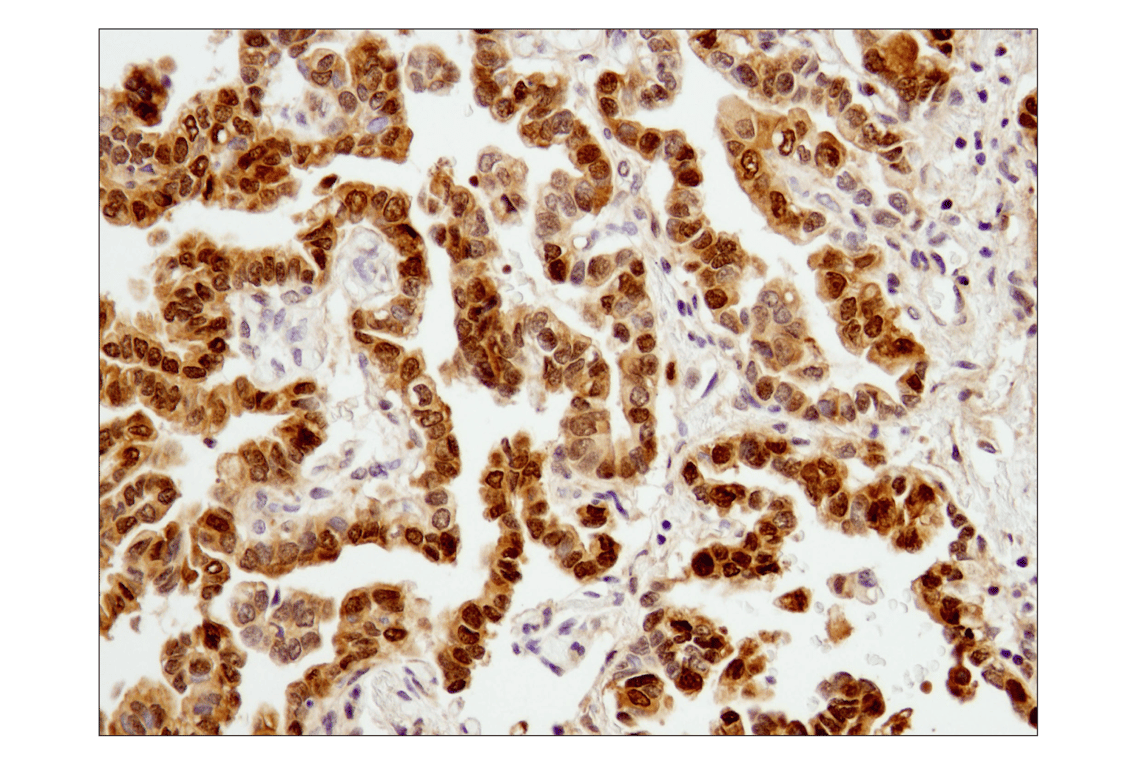 undefined Image 31: Stat Antibody Sampler Kit II