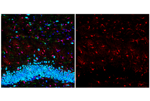 Immunofluorescence Image 3: S100B (E7C3A) Rabbit Monoclonal Antibody