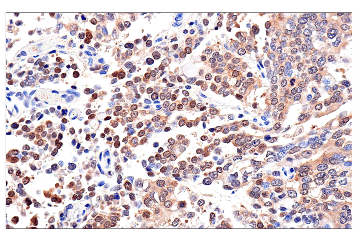 Immunohistochemistry Image 1: Caspase-8 (F5K9P) Rabbit Monoclonal Antibody (BSA and Azide Free)