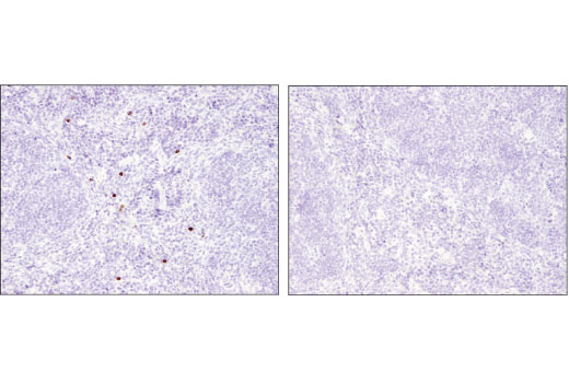 Immunohistochemistry Image 3: Olfm4 (D6Y5A) Rabbit Monoclonal Antibody