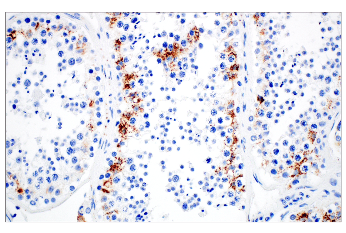 Immunohistochemistry Image 13: Perilipin-2 (E6G6M) Rabbit Monoclonal Antibody