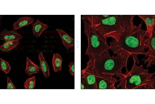Immunofluorescence Image 1: SUZ12 (D39F6) Rabbit Monoclonal Antibody (BSA and Azide Free)