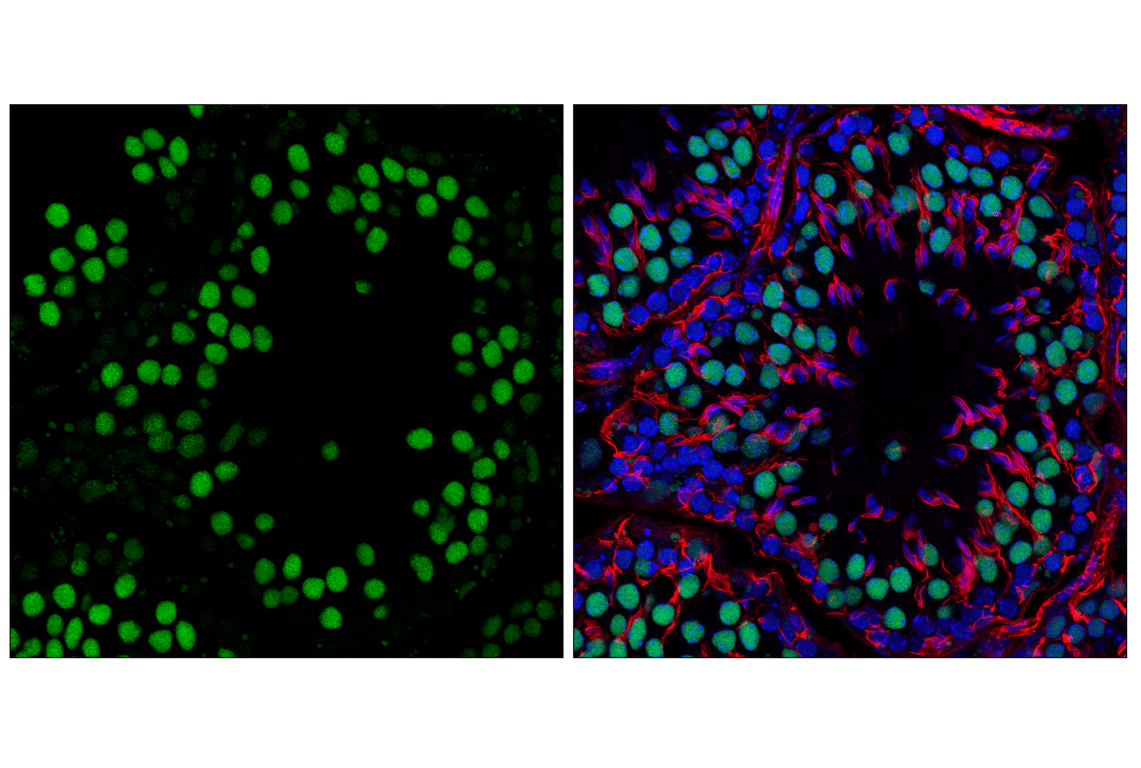 Immunofluorescence Image 1: Anillin (F6M2V) Rabbit Monoclonal Antibody