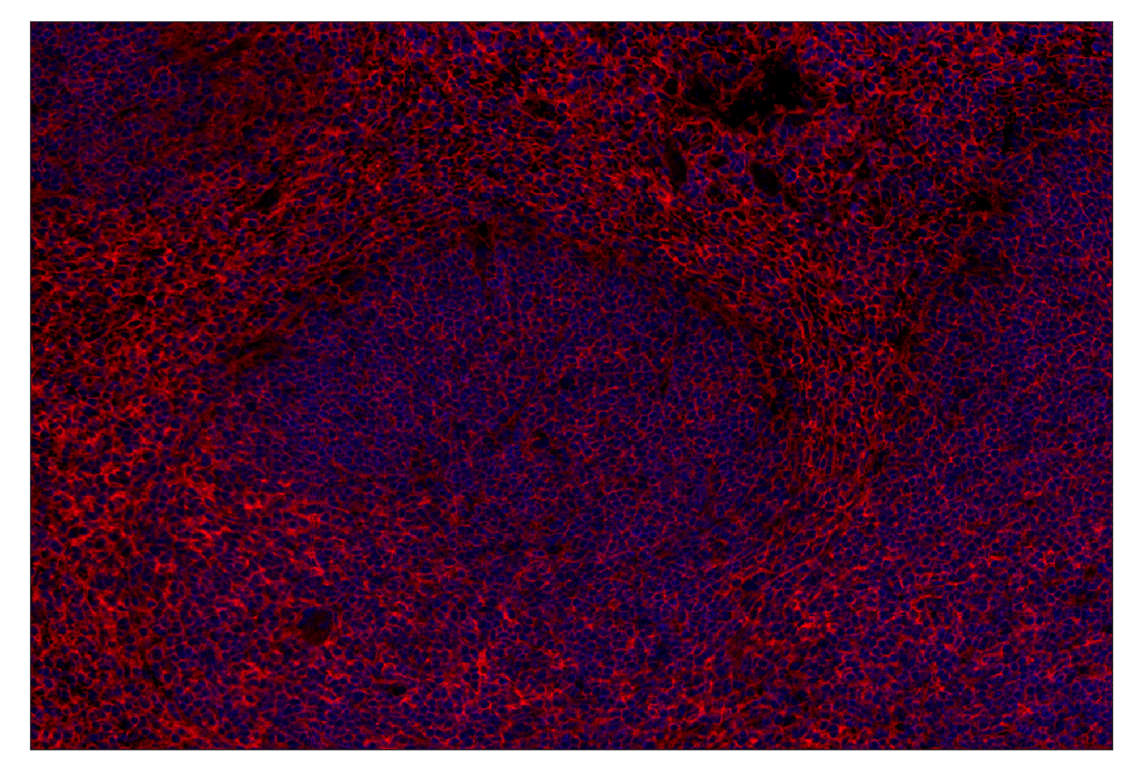 Immunohistochemistry Image 2: CD47 (E2V9V) Rabbit Monoclonal Antibody (Alexa Fluor<sup>®</sup> 647 Conjugate)