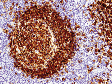 Immunohistochemical analysis of paraffin-embedded human tonsil using CD19 (Intracellular Domain) (D4V4B) XP<sup>®</sup> Rabbit mAb.