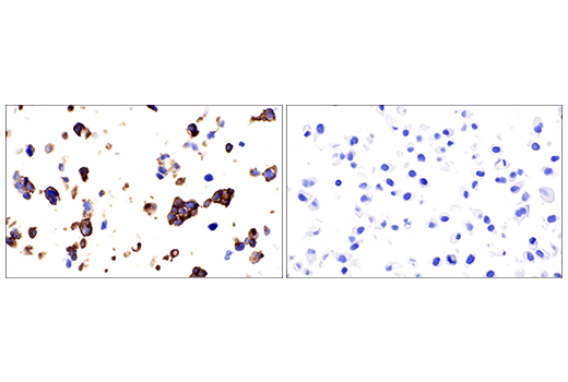 Immunohistochemistry Image 2: VE-Cadherin (E6N7A) Rabbit Monoclonal Antibody (BSA and Azide Free)