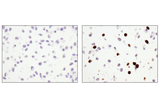 undefined Image 42: beta-Amyloid Mouse Model Neuronal Viability IF Antibody Sampler Kit