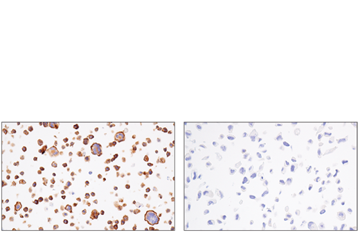 Immunohistochemistry Image 6: Semaphorin-4D/CD100 (E5C3B) Rabbit Monoclonal Antibody (BSA and Azide Free)