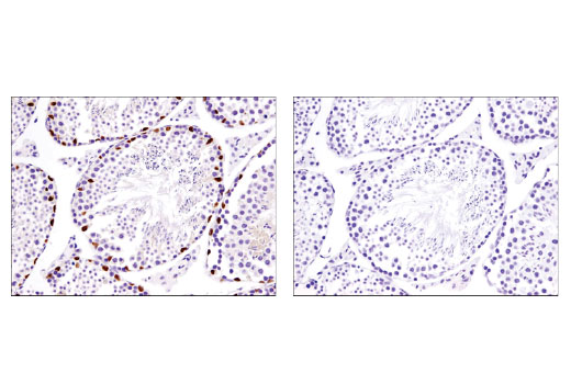 Immunohistochemistry Image 5: Sox9 (D8G8H) Rabbit mAb