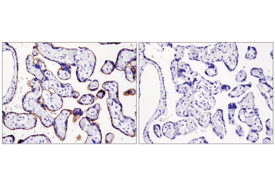 Immunohistochemistry Image 2: PD-L1 (E1L3N) Rabbit Monoclonal Antibody (BSA and Azide Free)