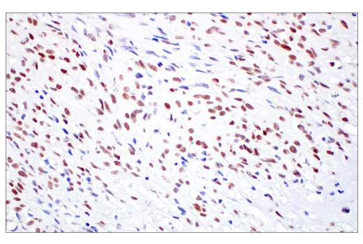 Immunohistochemistry Image 3: TIF1 alpha/TRIM24 (E9T3N) Rabbit Monoclonal Antibody