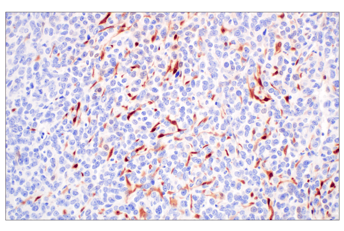Immunohistochemistry Image 9: Phospho-p44/42 MAPK (Erk1/2) (Thr202/Tyr204) (D13.14.4E) Rabbit Monoclonal Antibody (BSA and Azide Free)