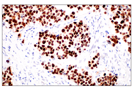 Immunohistochemistry Image 1: p53 (DO-1) Mouse Monoclonal Antibody