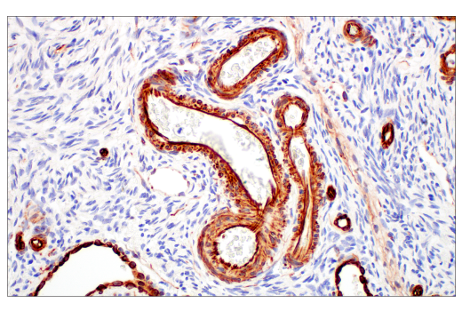 Immunohistochemistry Image 8: Nestin (E4O9E) Rabbit Monoclonal Antibody (BSA and Azide Free)